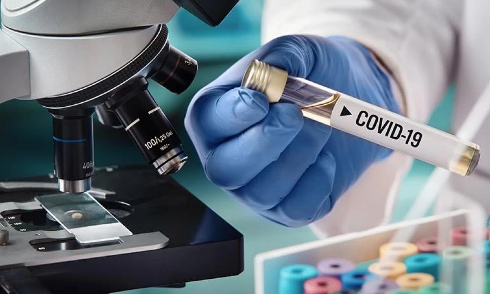 Βανταράκης: Τα απαραίτητα τεστ, ο δείκτης θνησιμότητας και η χαμηλή ανοσία